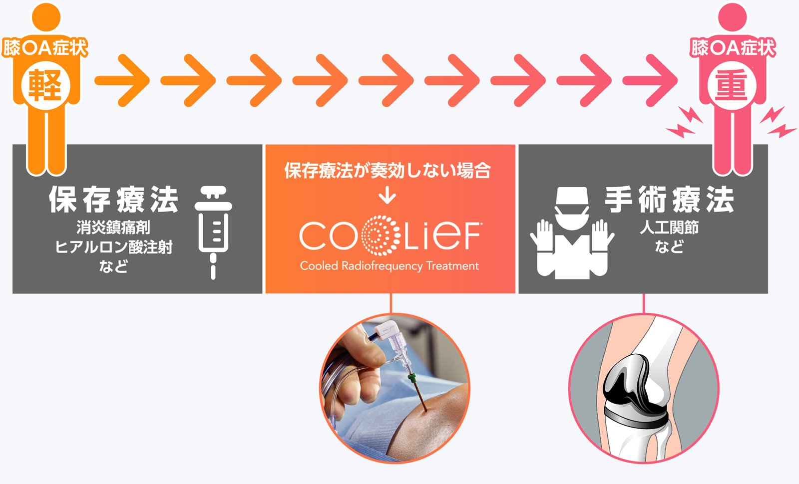 クーリーフ治療の対象について