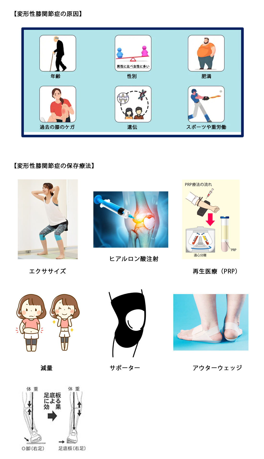 変形性膝関節症