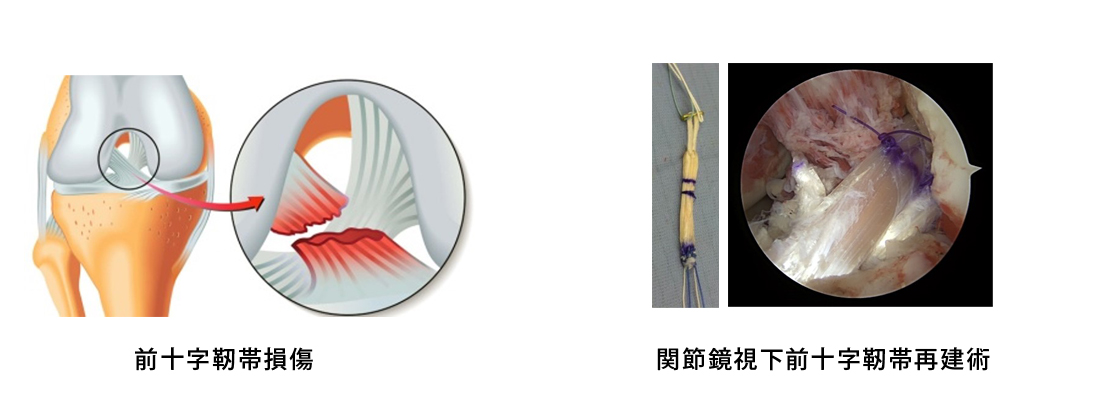 下肢（膝・足関節）のスポーツ整形外科 | 東京スポーツ&整形外科